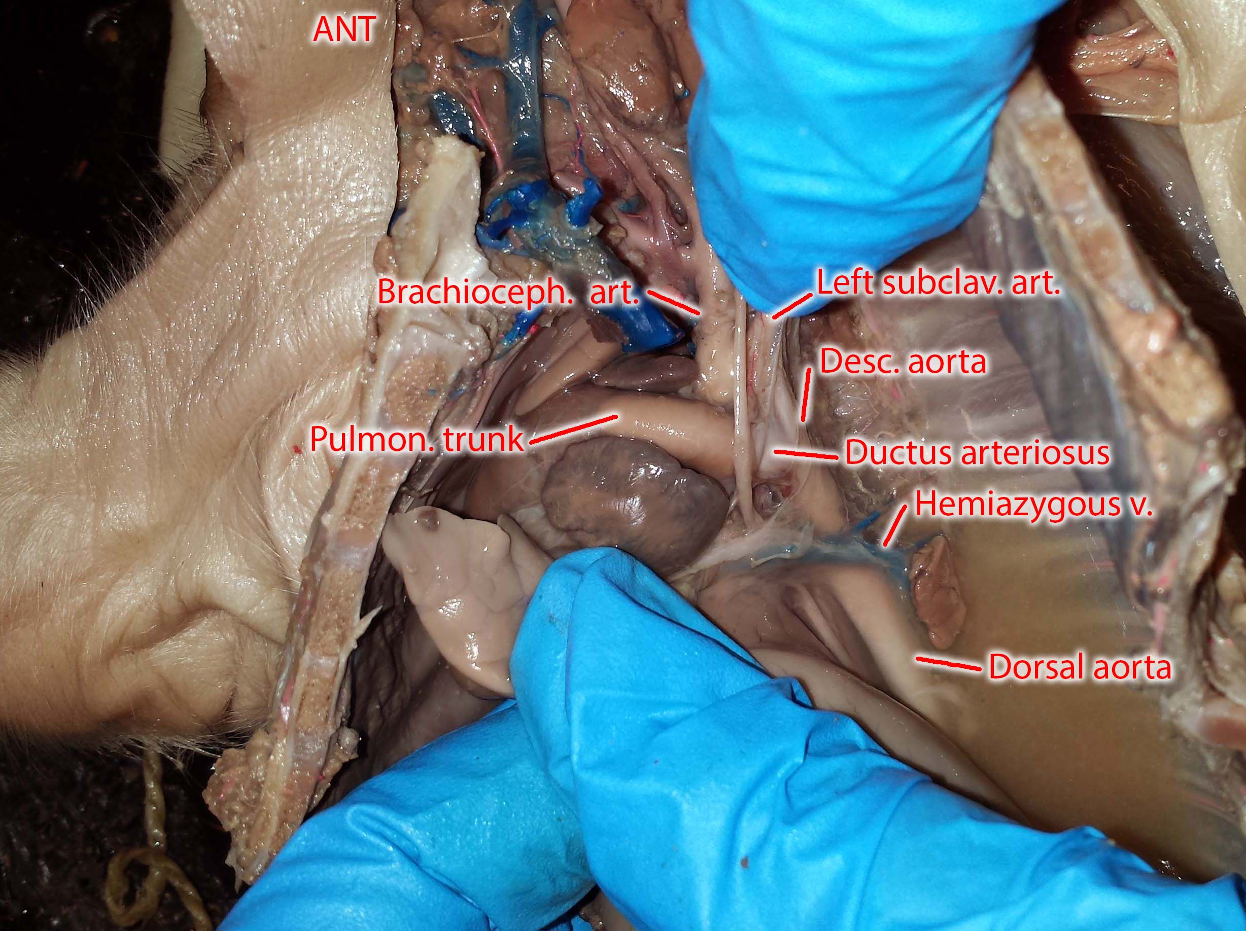 Photographs of the Vessels of the Fetal Pig