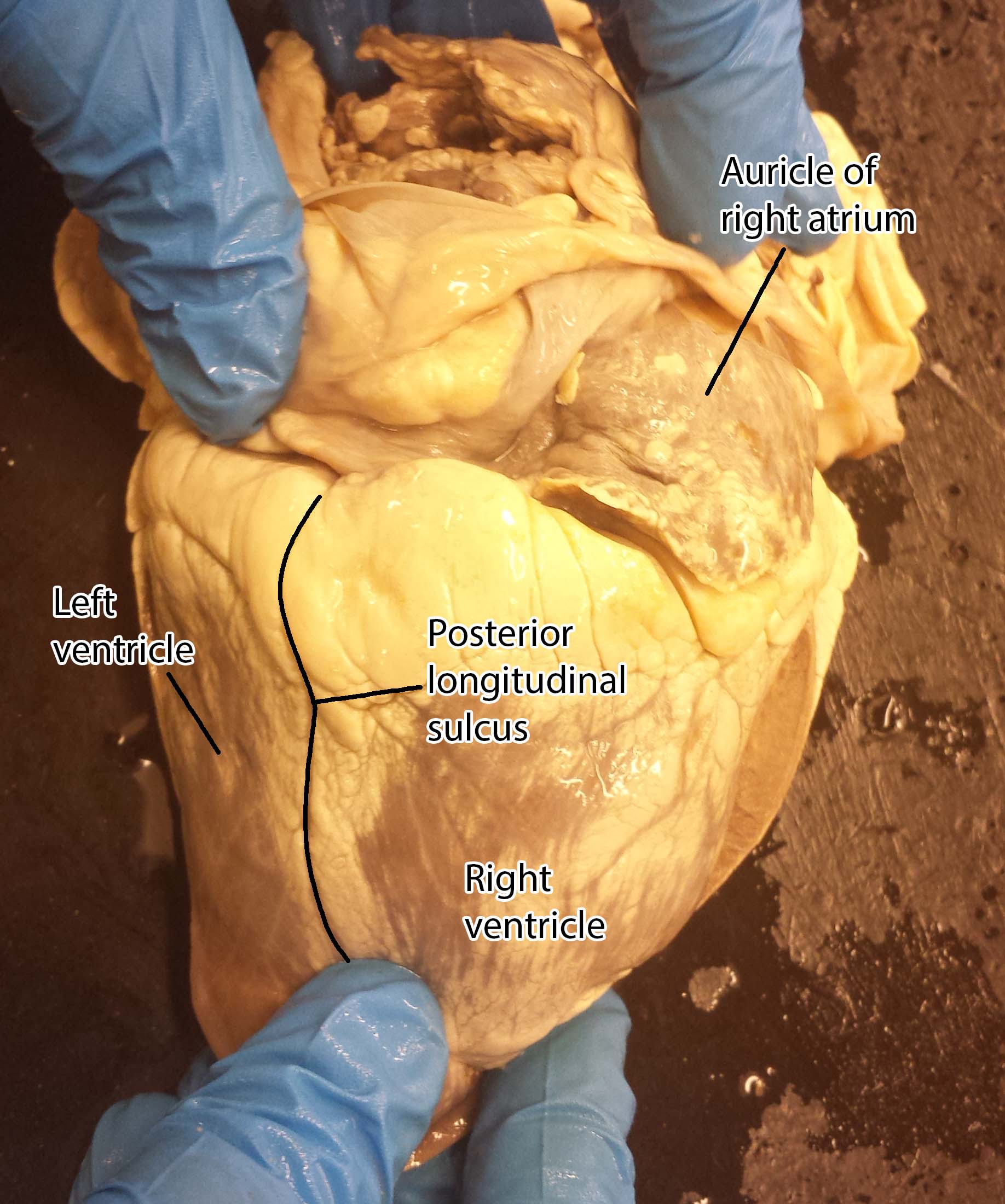 Heart Dissection Photos