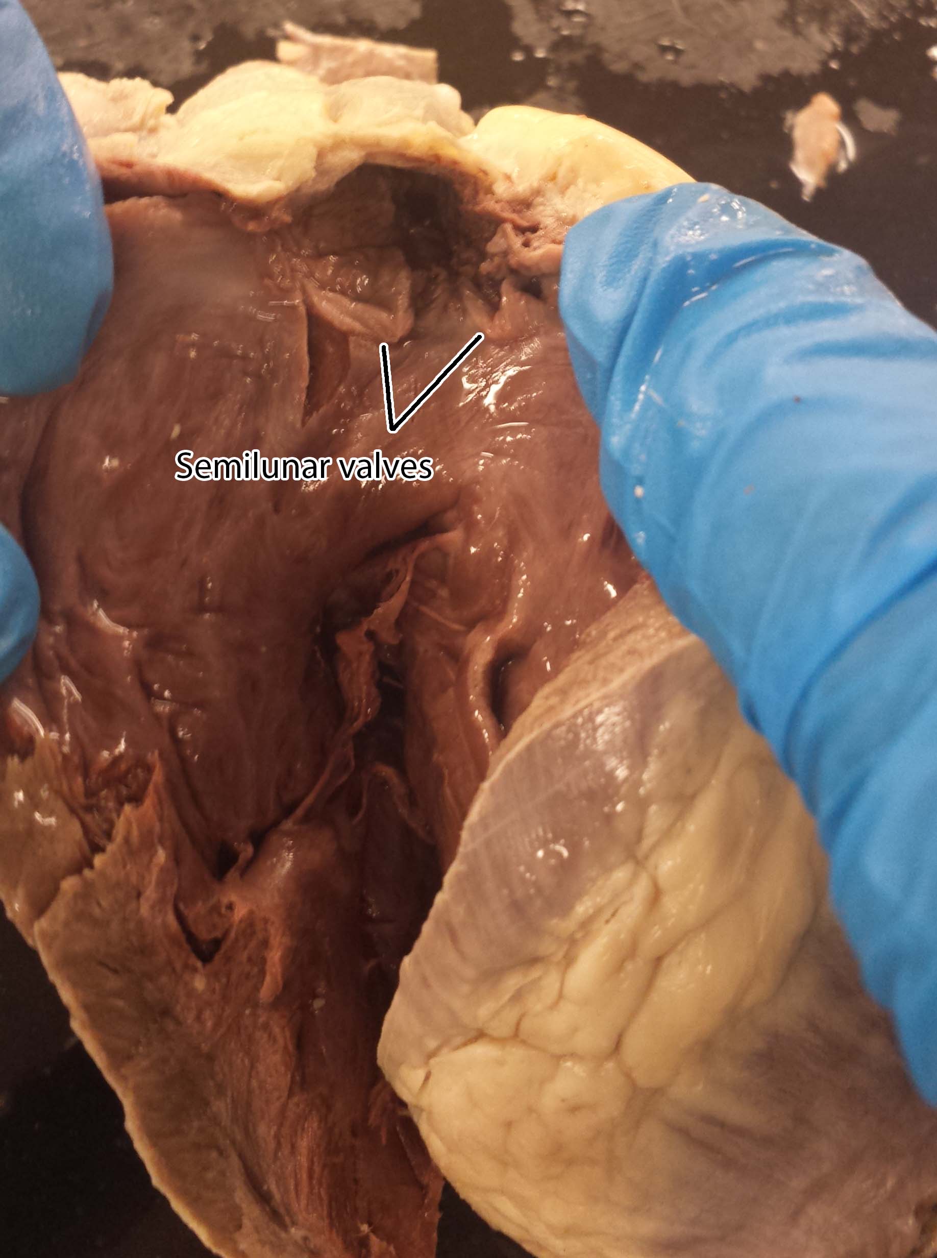 Heart Dissection Photos